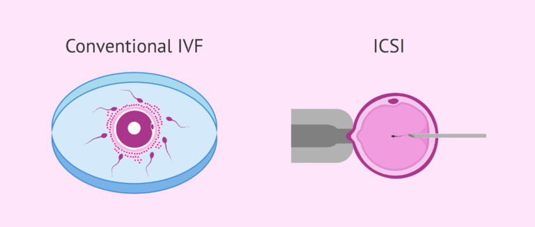 https://sattvafertility.com/ivf-hospital-in-bangalore/