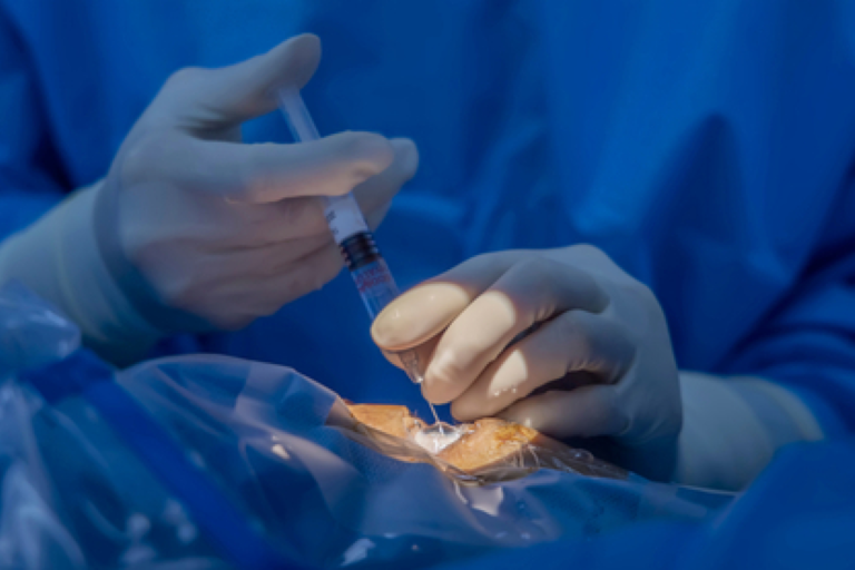 Causes and Symptoms of Internal Eye Infections Frame-22-9-1