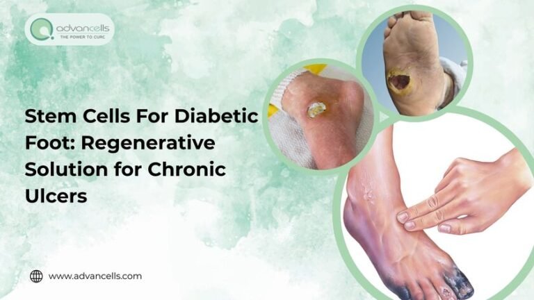 Stem Cells For Diabetic Foot: Regenerative Solution for Chronic Ulcers Stem-Cells-For-Diabetic-Foot